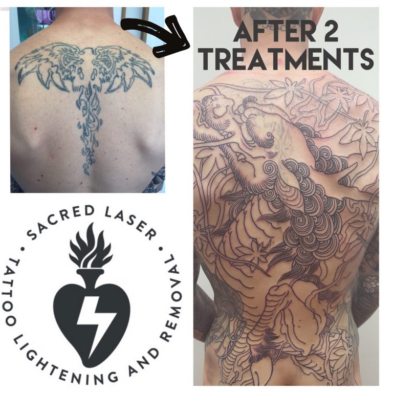 Cover up your old Tattoo by clearing the way with Tattoo