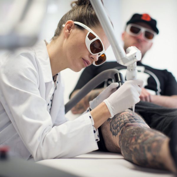 Laser Tattoo Removal using the Cynosure MedLite C6 lifts Industry Standards